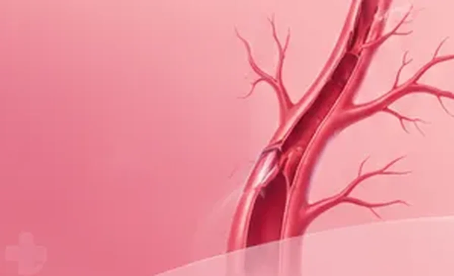 Illustration of a blood vessel used across the Lux Hospitals health library