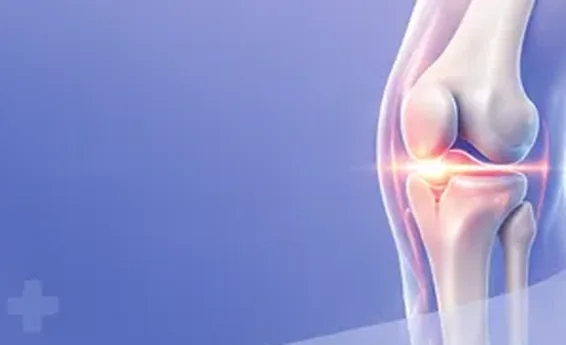 Illustration of a knee joint